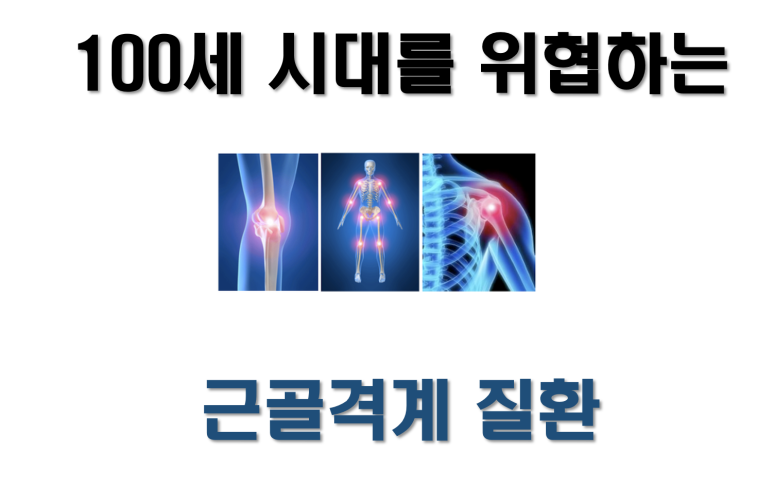 굿조인 이미지
