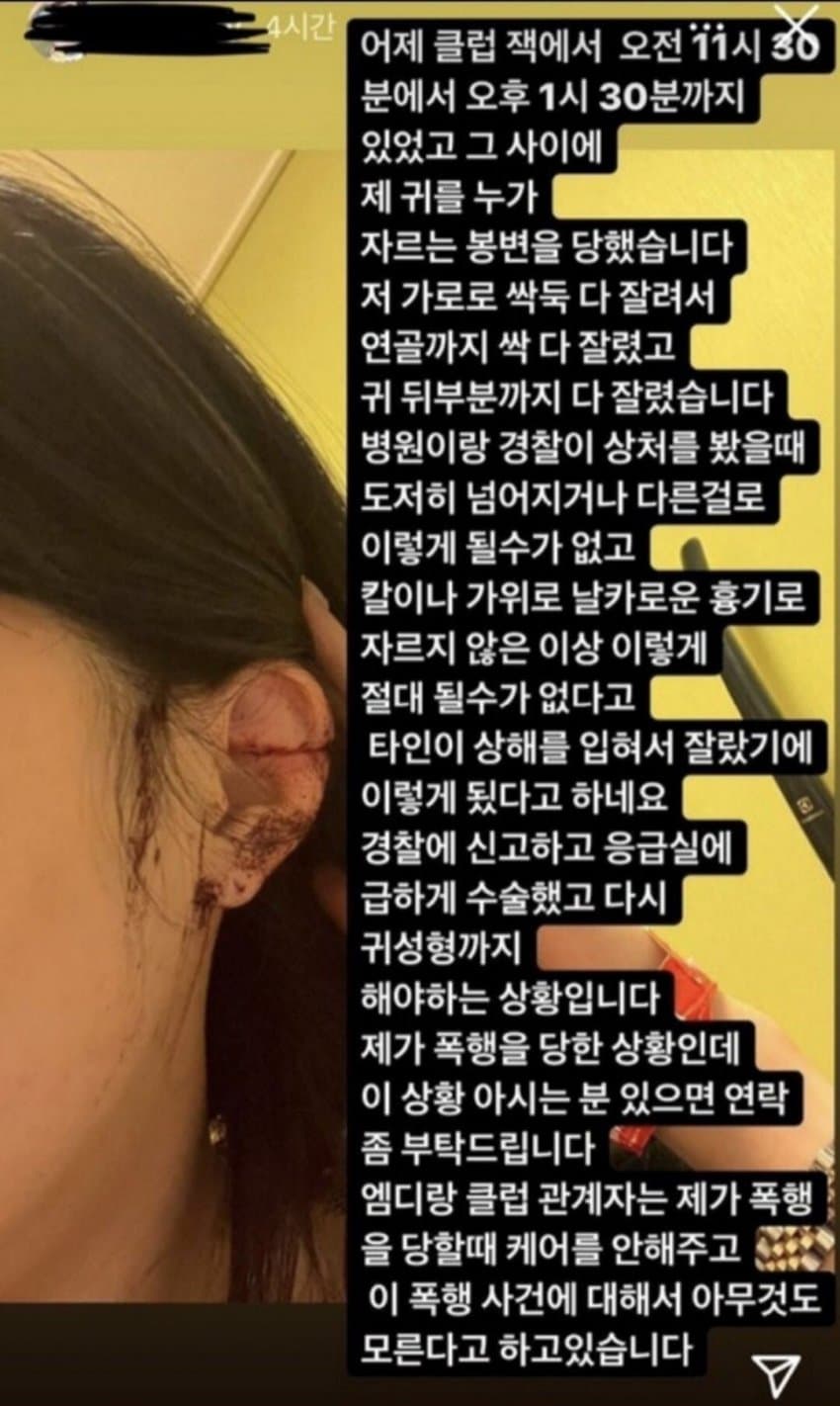 가위클럽 이미지