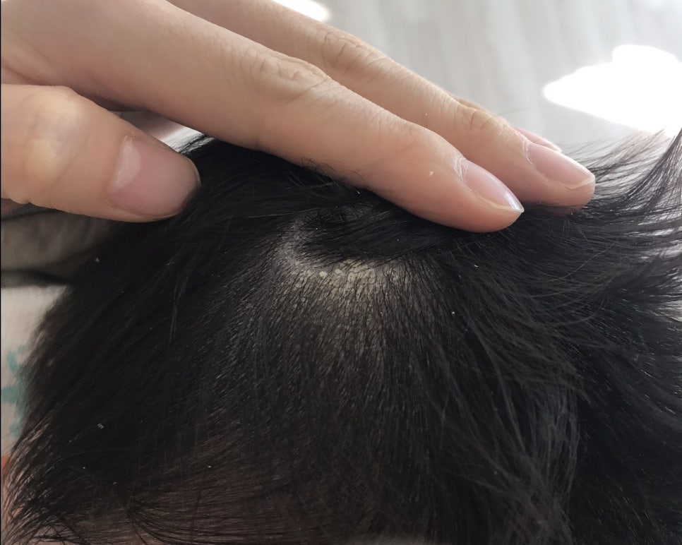 깨끗태진 이미지