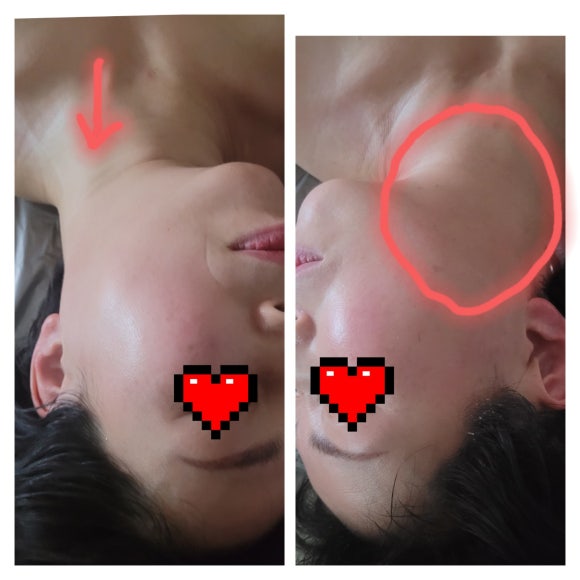 초이테라피 이미지
