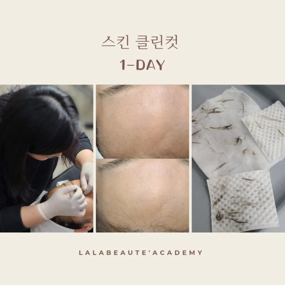 라라스킨 이미지