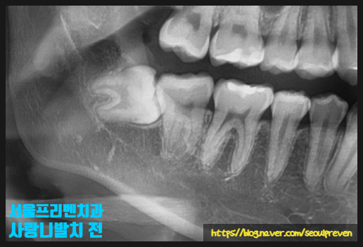 서울프리벤치과의원 이미지
