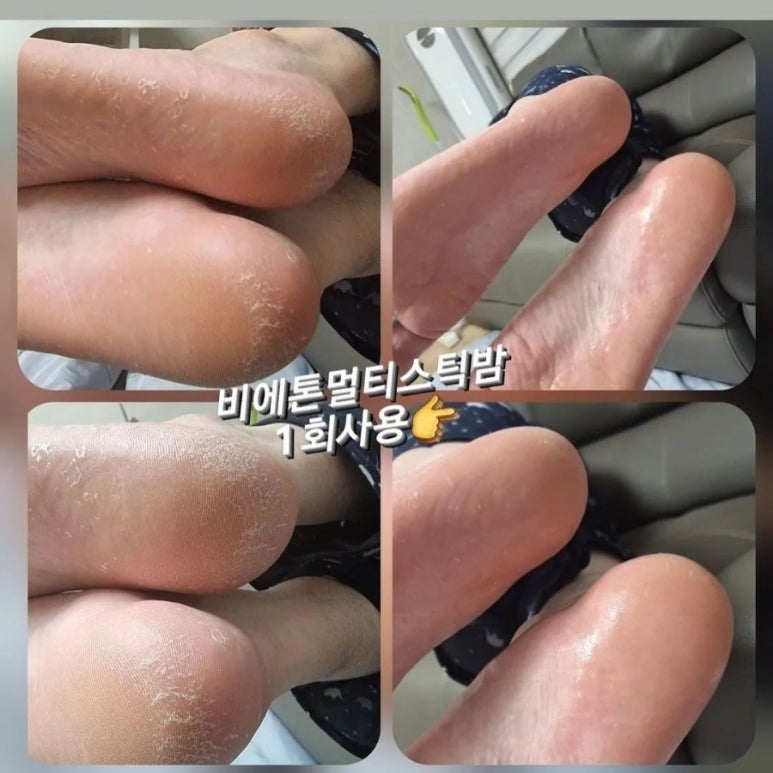 인셀덤 대구 이미지