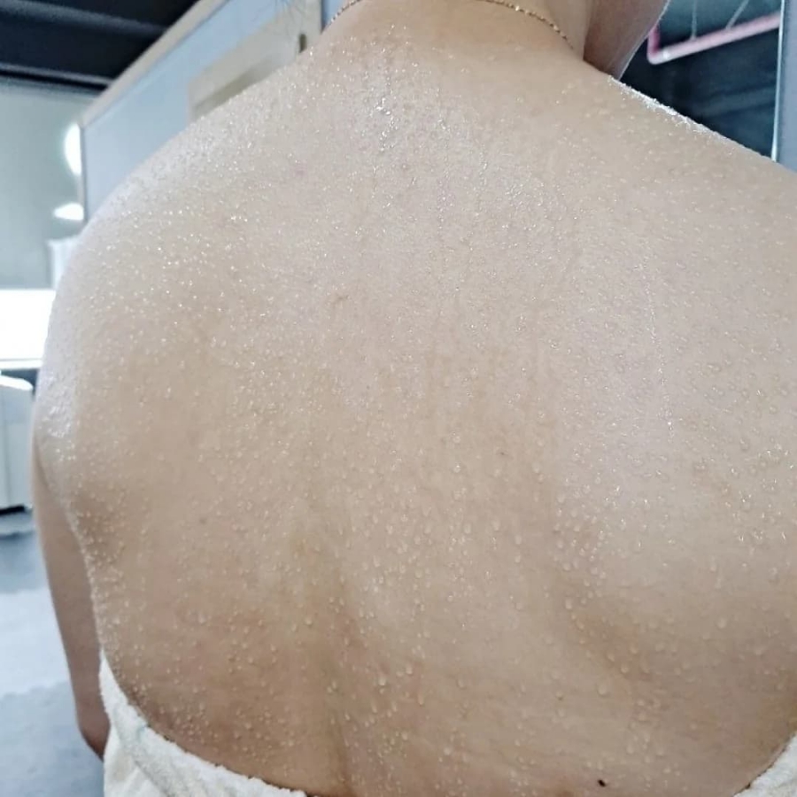 스토리조아 이미지