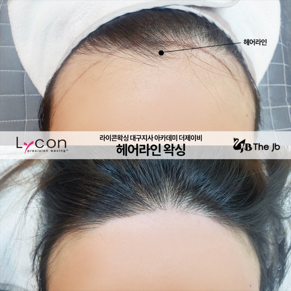 제이비라인 이미지