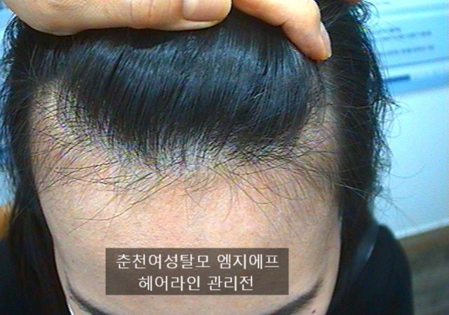 1cm 헤어 이미지