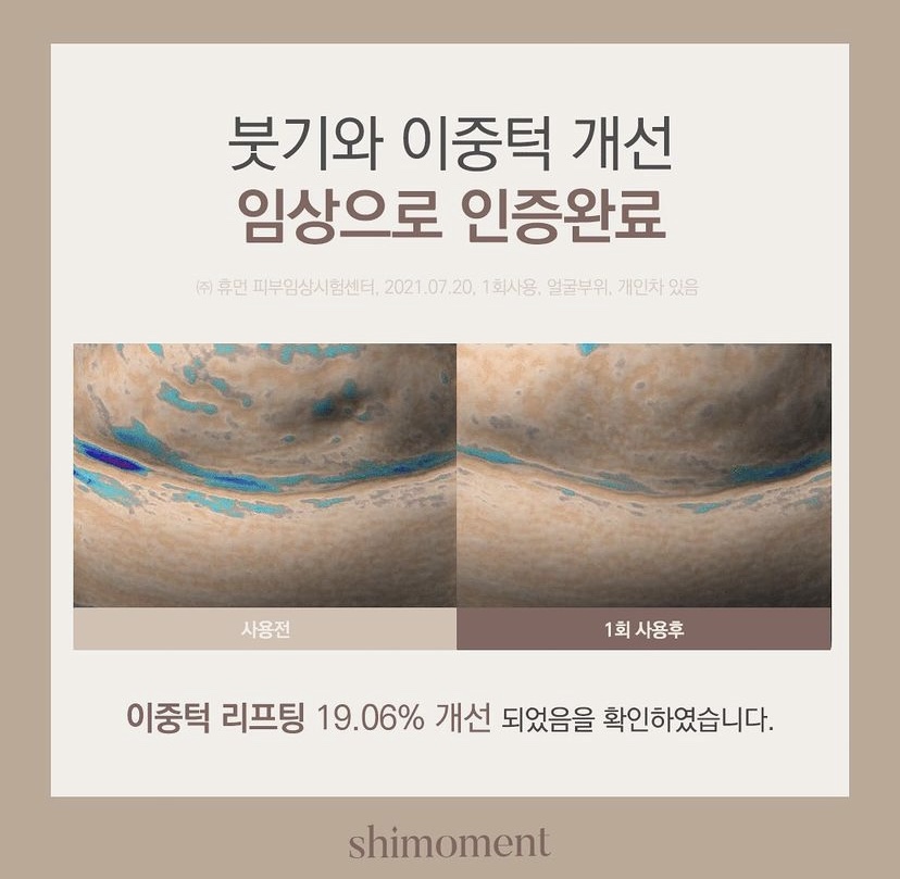 브이홈케어 이미지