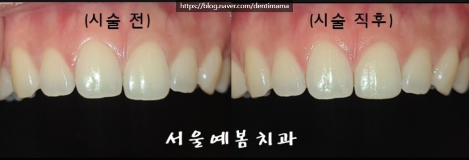 서울예봄치과 이미지