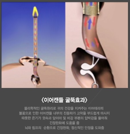 초이테라피 이미지