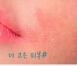 더고은피부관리실 이미지