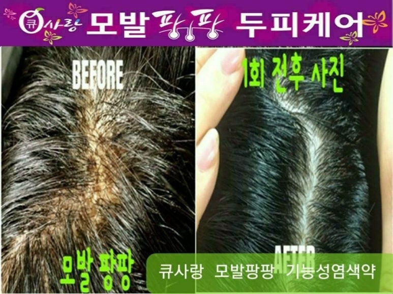 큐케어 이미지