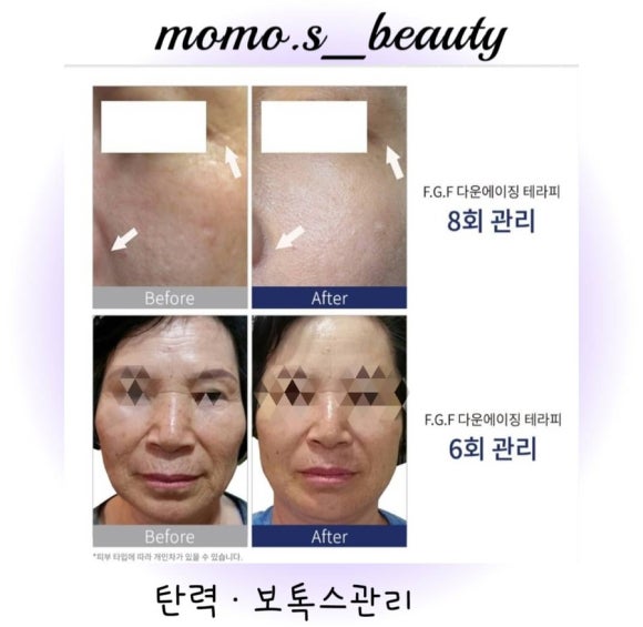 모모뷰티 이미지