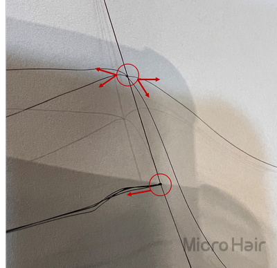 마이크로헤어증모 이미지