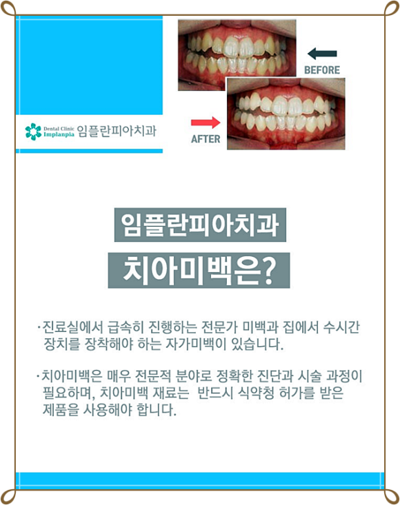 임치과의원 이미지
