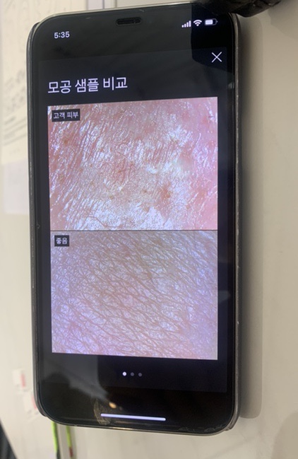 뷔에르 이미지
