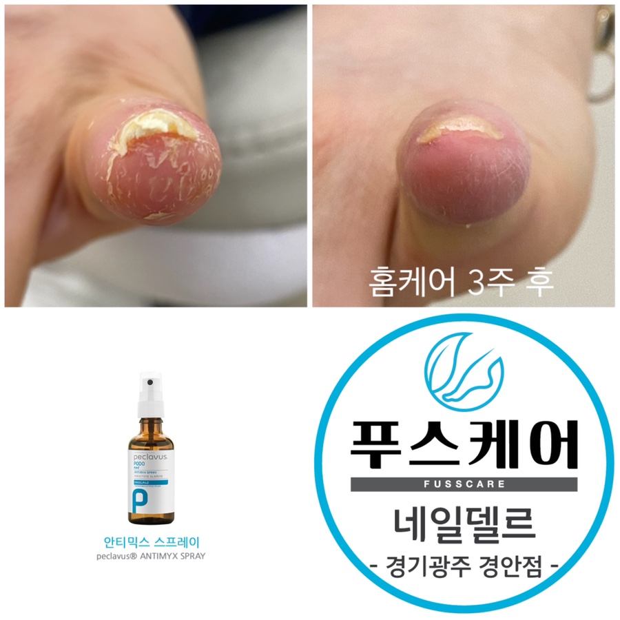 네일델르 이미지