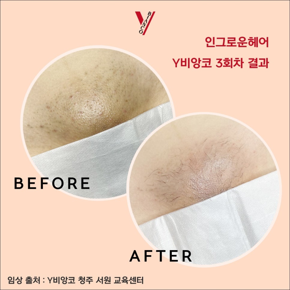 Y&헤어 이미지