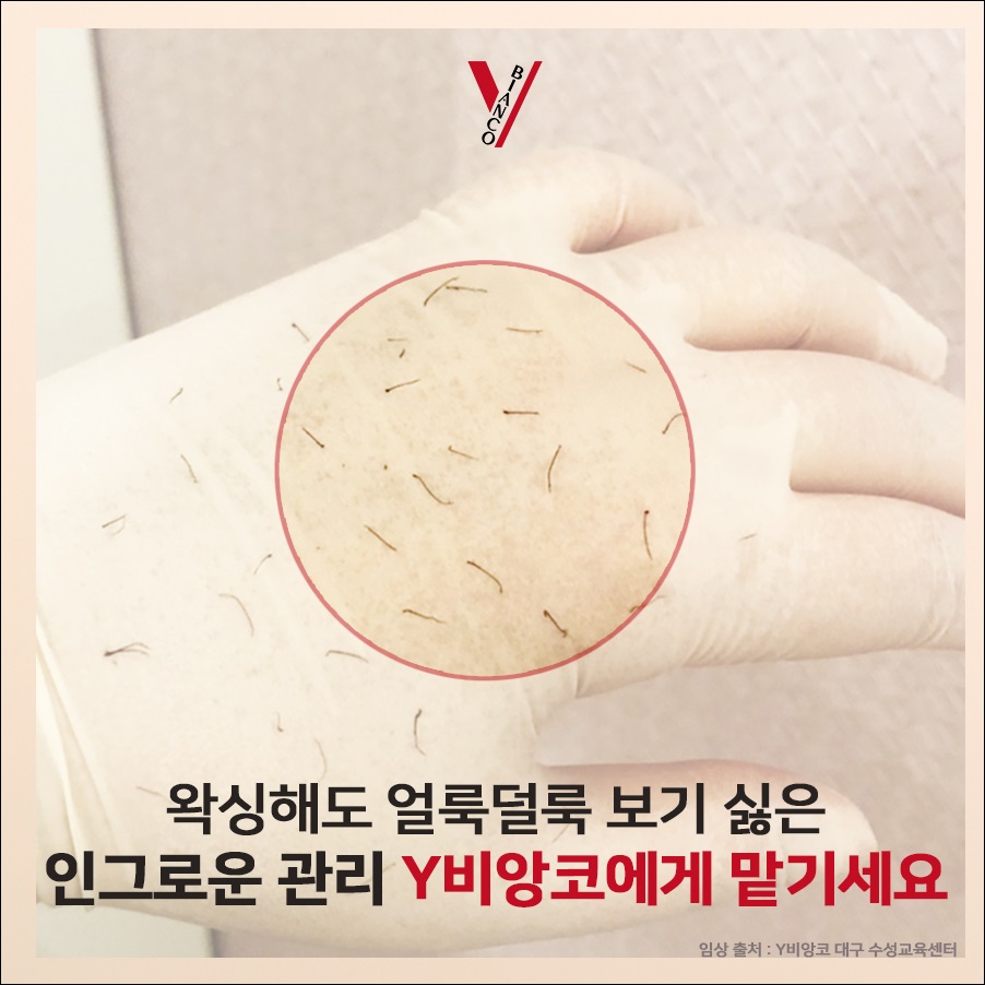 Y&헤어 이미지