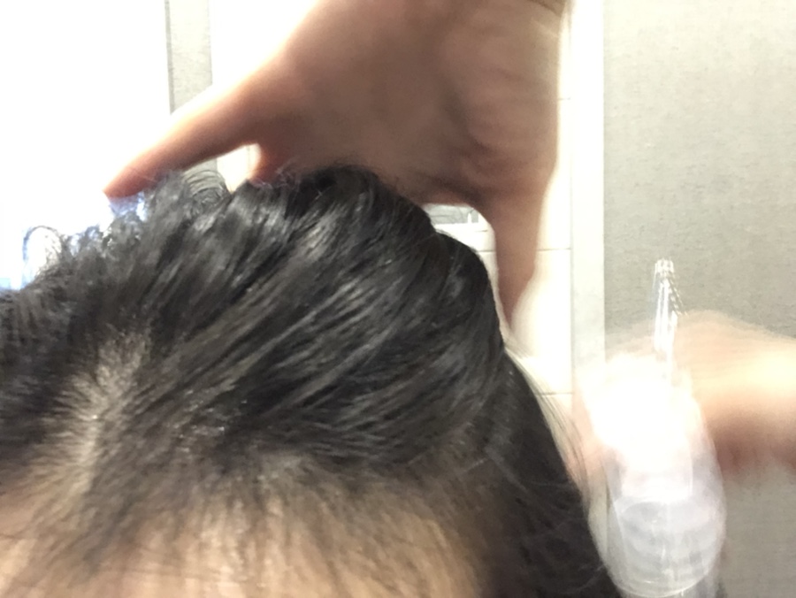 탑스칼프인천점 이미지