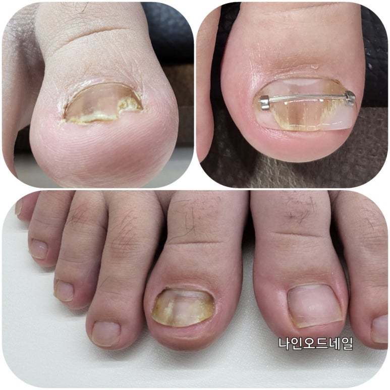 네일나인 이미지