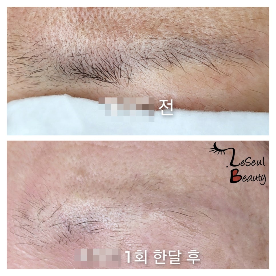 레쓸 이미지