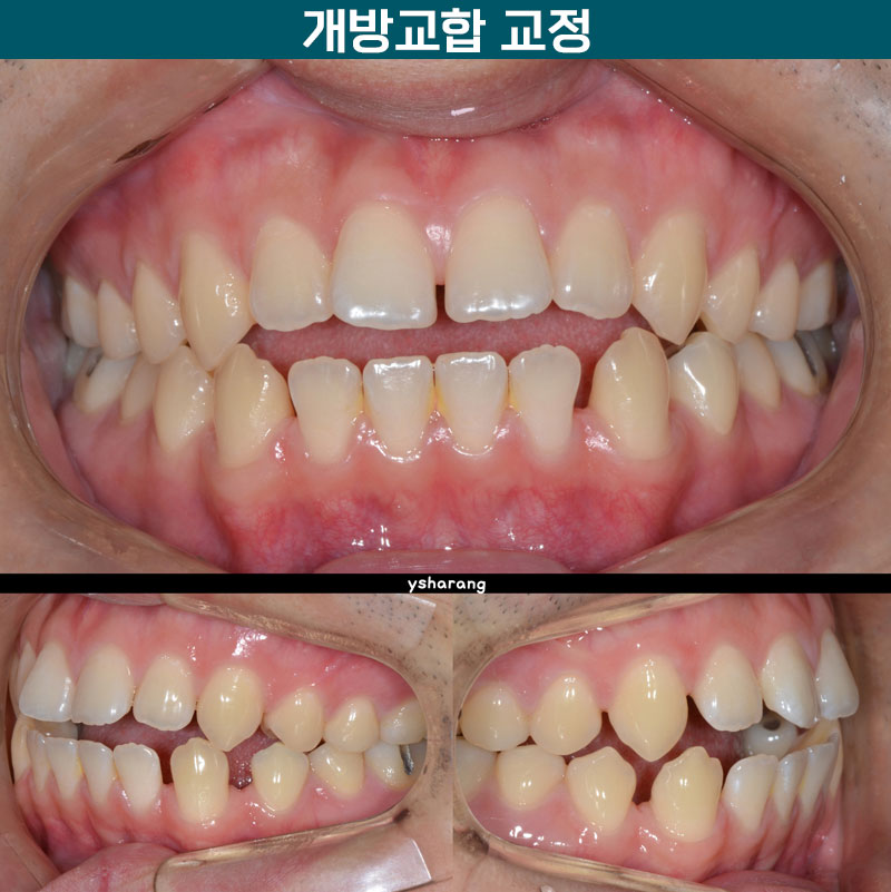 연세하랑치과의원 이미지