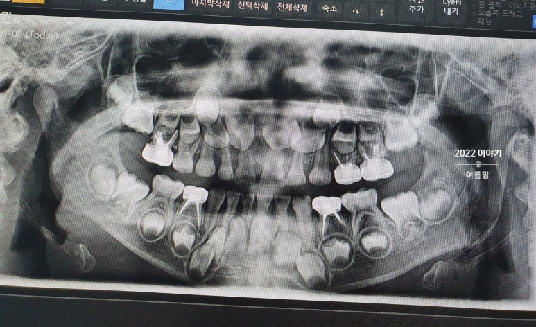 키즈웰치과 이미지