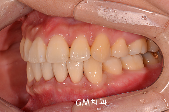 GM치과 이미지