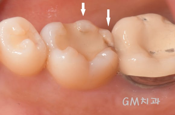 GM치과 이미지