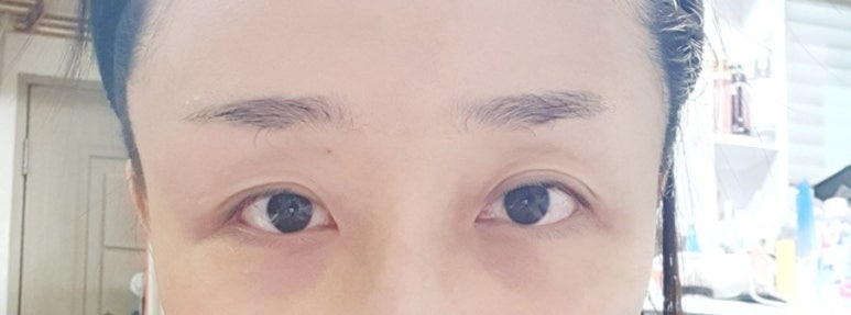 포베리 이미지