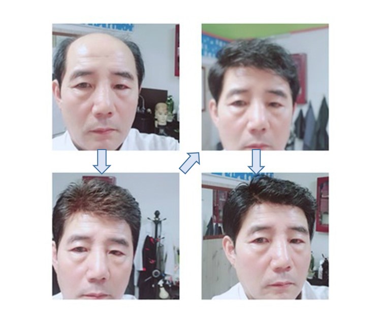에이모가발 이미지