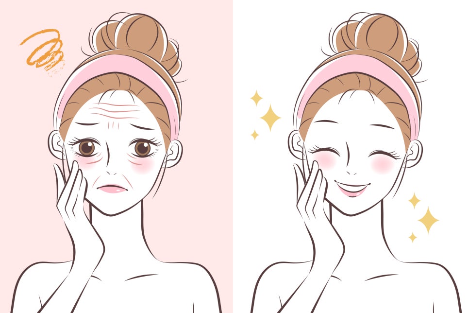 르네뜨르 이미지