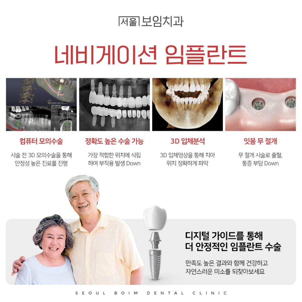 자연치아와 임플란트의 차이점 안내, image size:966x966