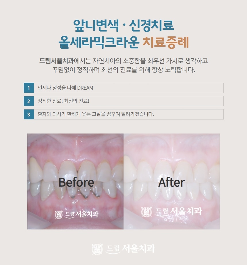 꾸밈치과 이미지