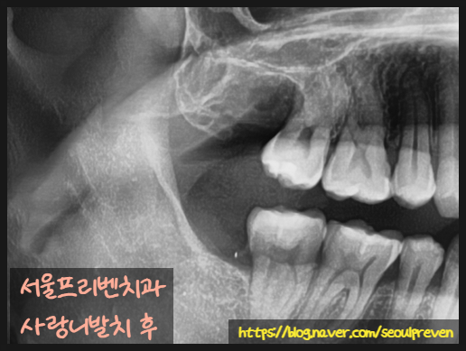 서울프리벤치과의원 이미지