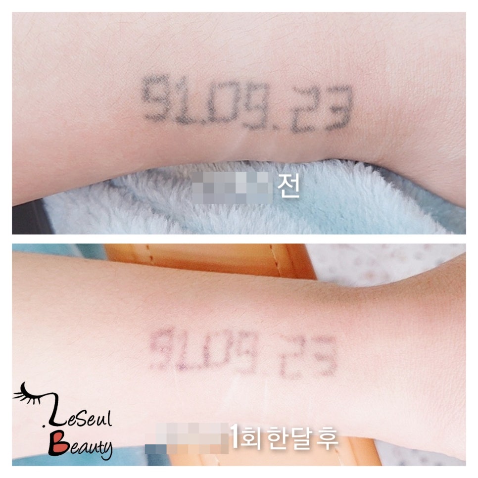 레쓸 이미지