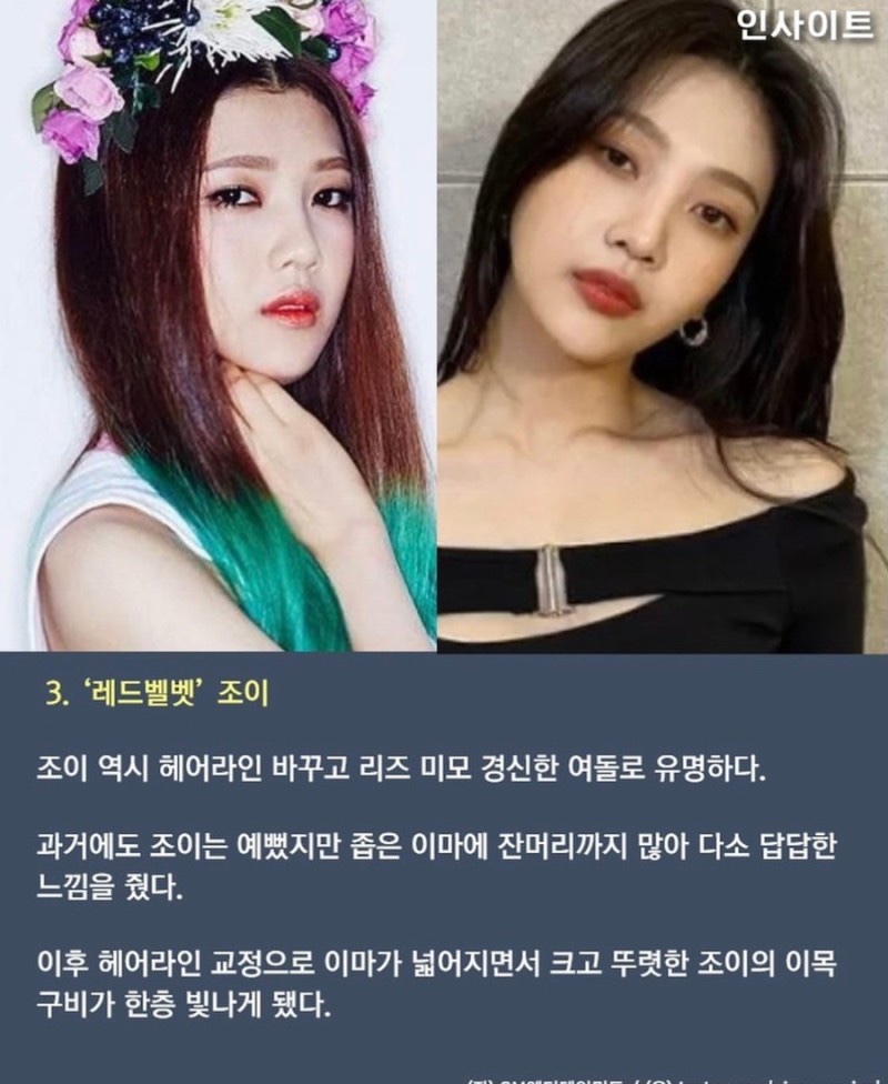 헤어라인 이미지