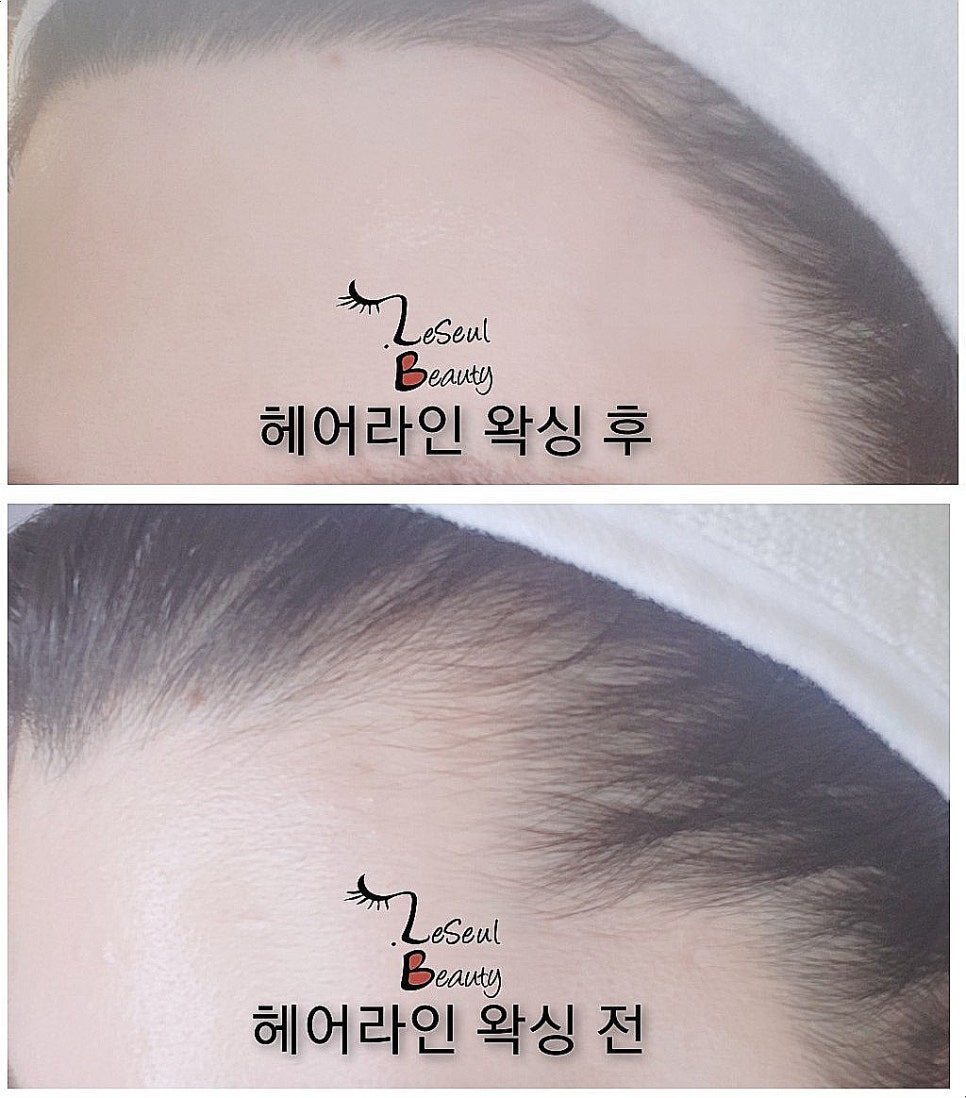 레쓸 이미지
