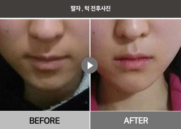 서울새로운피부과 이미지