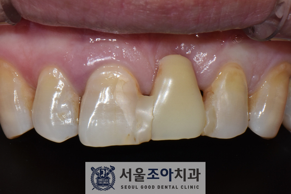 서울조아치과 이미지