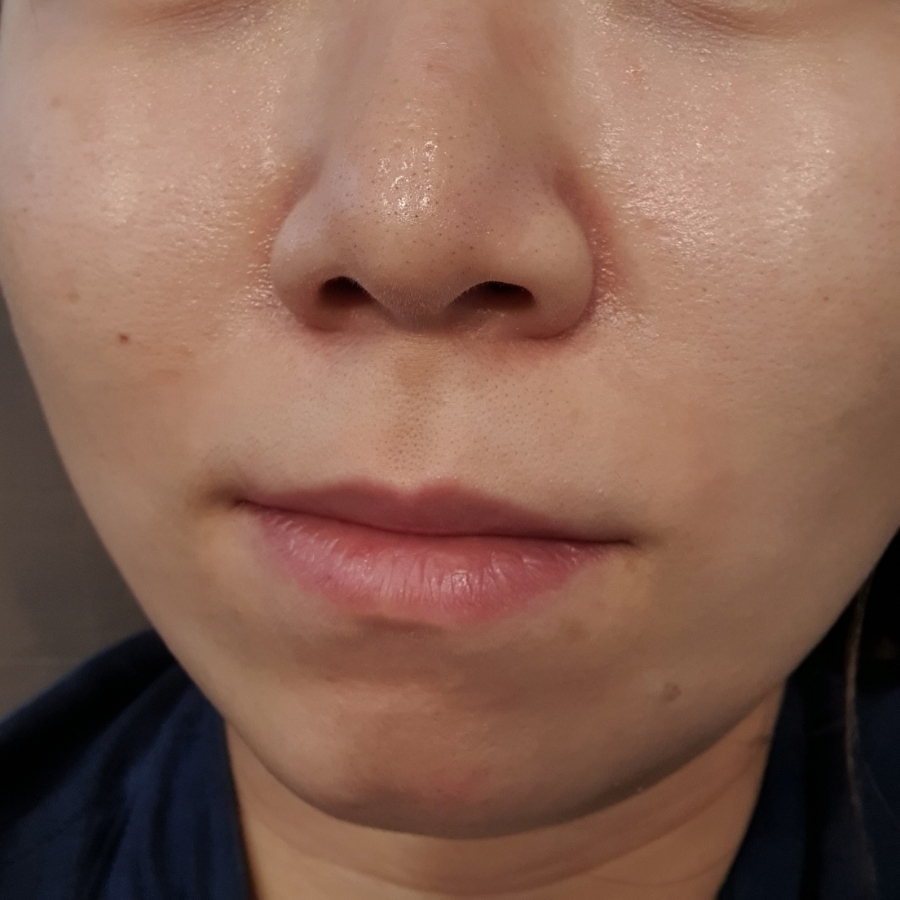 휴피부관리샾 이미지