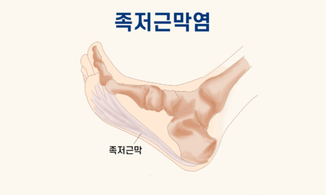 천하의벽포짐 이미지