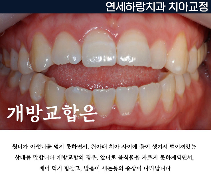 연세하랑치과의원 이미지