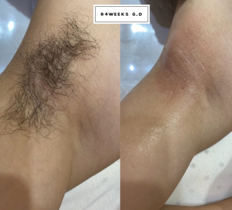 리포윅스 슈가링왁싱 검단신도시점 이미지