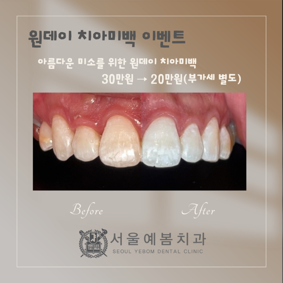 서울예봄치과 이미지