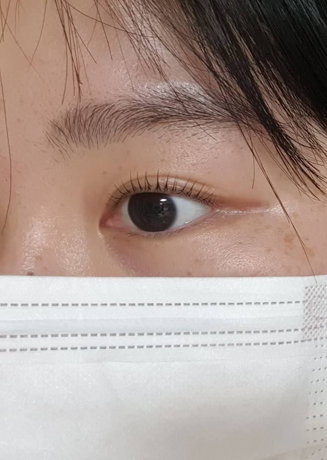 어나더에이치 이미지