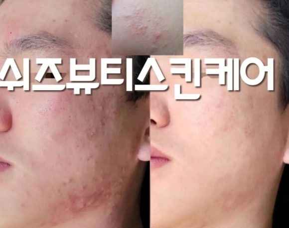 쉬즈뷰티에스테틱 이미지