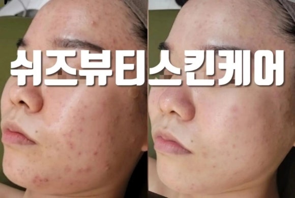 쉬즈뷰티에스테틱 이미지