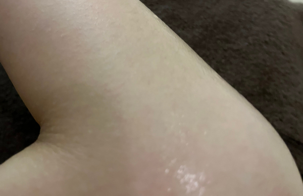 미사바이오포톤 이미지