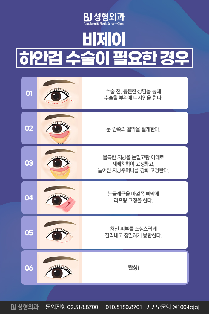 비제이솔루션 이미지